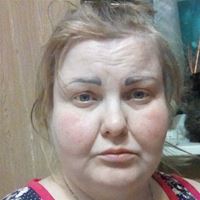 Сиделка, Химки, улица Мичурина, Сходня, Светлана Васильева